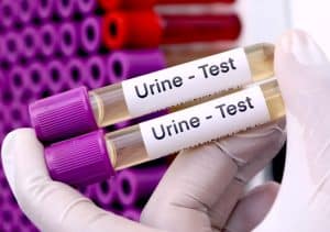 A gloved hand holding two small vials of urine for a urine test